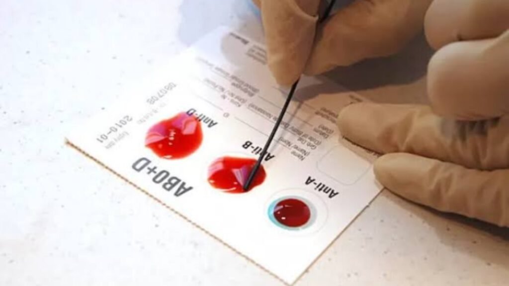 Ilustrasi golongan darah o dipercaya sebagai darah paling tahan banting (.inet)